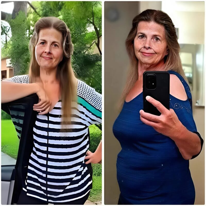 წლები იბრძოდა სიმძიმესთან და გამსჯელ თვალებთან… სანამ ერთმა გადამწყვეტმა წამმა მისი ცხოვრება შეცვალა. აი, ასე გამოიყურება ახლა.